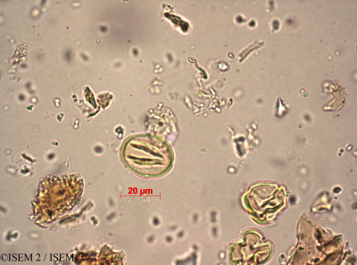 ISEM 2/Rawsonia_lucida_12726/Rawsonia_lucida_12726_0001(copy)_thumb.jpg